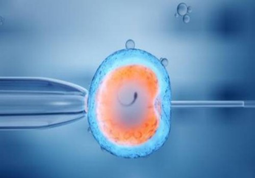 羊水穿刺染色體報告解讀：是男孩還是女孩一目了然！